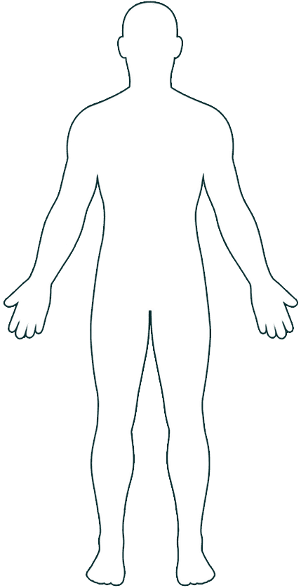 Body Diagram